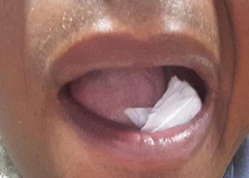 Menor é apreendido com droga dentro da boca