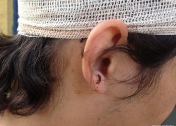 CIÚMES – Mulher diz que vai retornar para o ex e leva facada na cabeça