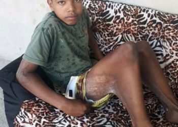 Adolescente de 14 anos que quer voltar a andar tem consulta agendada pela Prefeitura para hoje