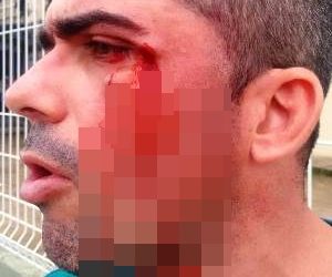 URGENTE – Homem diz ter sido agredido por vereador em Linhares; Vídeo