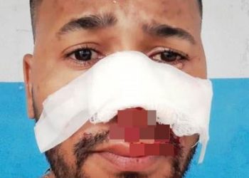 Batata da Banca do Cerqueira sofre acidente; Vídeo