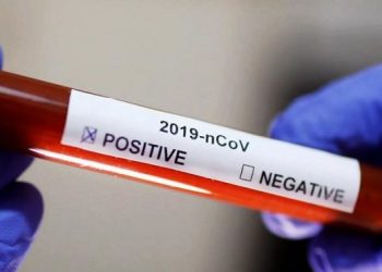 Confirmado primeiro caso de coronavírus no Espírito Santo