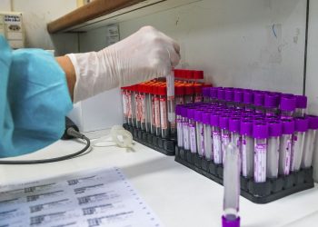 Nove em 10 pacientes curados da covid-19 apresentam efeitos colaterias