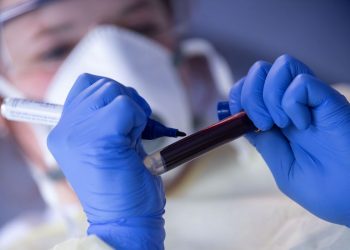 Casos semanais de covid-19 voltam a subir no Brasil