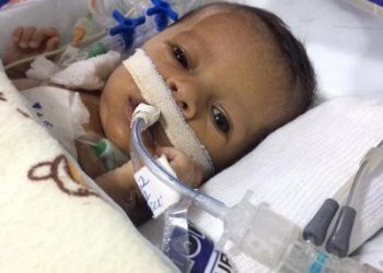 EM LINHARES – Criança com menos de um mês de vida passa por três cirurgias e família precisa de ajuda