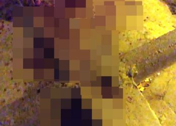 VIOLÊNCIA – Homem leva dois tiros no rosto em Sooretama