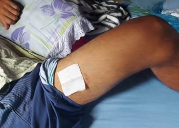 VÍDEOS – Polícia investiga caso de jovem atingido por tiro disparado por policial civil em Bebedouro