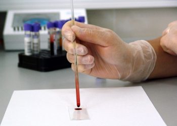 Grávida que recebeu falso resultado de HIV deve ser indenizada