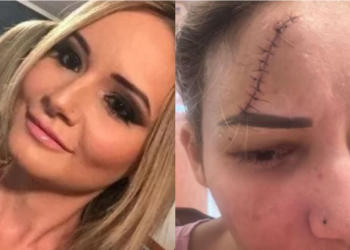 Médica morta em Colatina – Surgem novos indícios de que a Dra. Juliana era espancada pelo marido