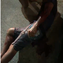 Tentativa de homicídio em Sooretama. Homem é atingido por golpes de faca.