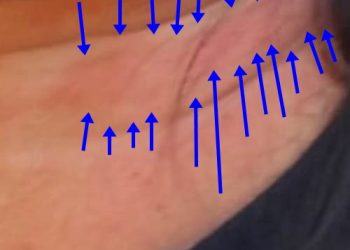 VÍDEO EXCLUSIVO – Assessora que denunciou presidente da Câmara de Vereadores de Linhares, por agressão, fala com Norte Notícia