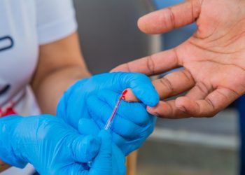 Dia Mundial de Luta contra a Aids: Naps promove caminhada de mobilização contra HIV nesta sexta-feira, 06