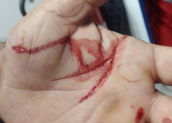 VÍDEO – Homem invade casa em Linhares e agride morador com extrema violência