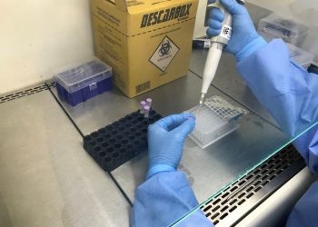 INFECÇÃO MISTERIOSA – Sesa descarta Covid-19 e confirma casos suspeitos em Linhares e Colatina. Veja boletim completo