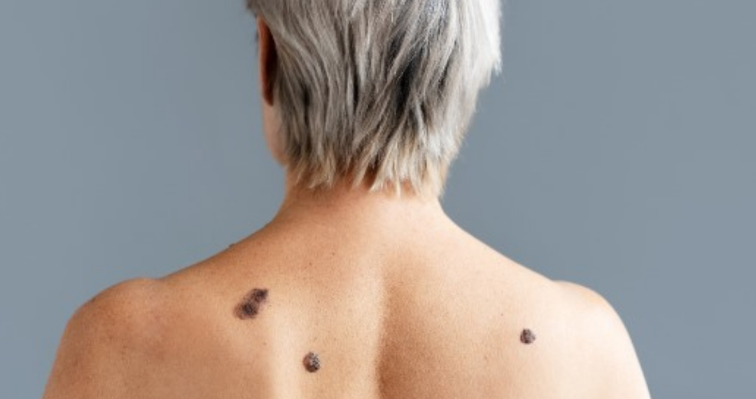 Foto - Reprodução Internet