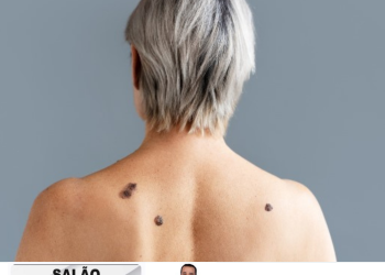 Dez anos de espera! Mutirão gratuito contra o câncer de pele volta a Linhares e promete salvar vidas